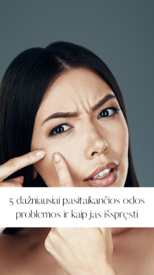 5 dažniausiai pasitaikančios odos problemos ir kaip jas išspręsti