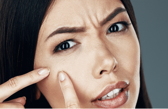 5 dažniausiai pasitaikančios odos problemos ir kaip jas išspręsti