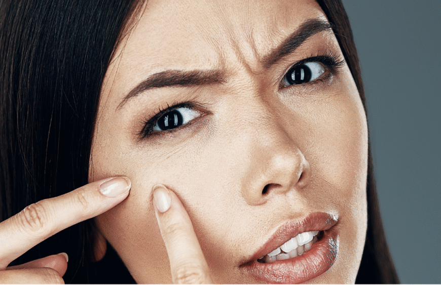 5 dažniausiai pasitaikančios odos problemos ir kaip jas išspręsti