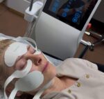 UMS Facial – neinvazinė veido raumenų ir odos atjauninimo procedūra